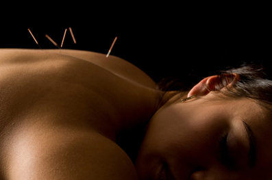 sarasota acupuncture